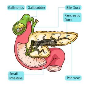 ARAD MEDICAL gall bladder