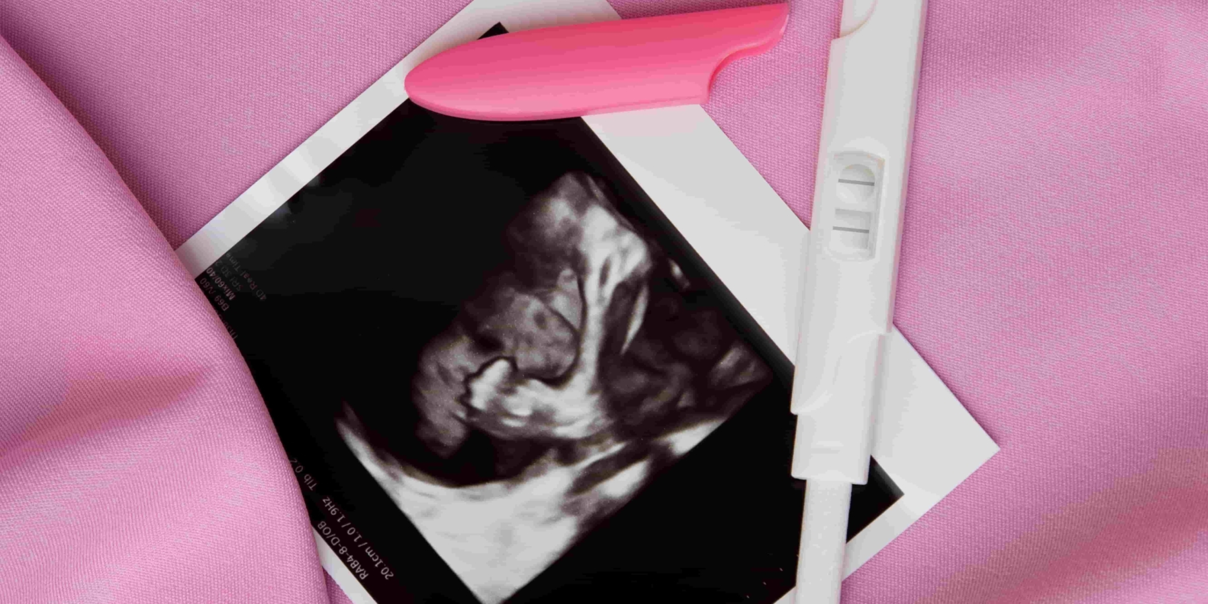 top-view-positive-pregnancy-test-ultrasound (1) top-view-positive-pregnancy-test-ultrasound (1)
